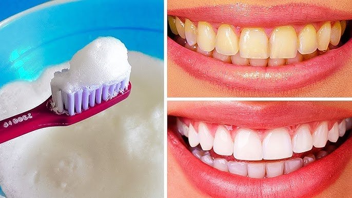 how to whiten teeth naturally at home